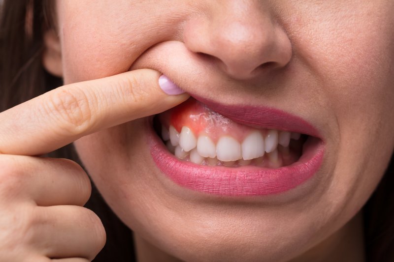 What Are the Different Gum Treatments Options?