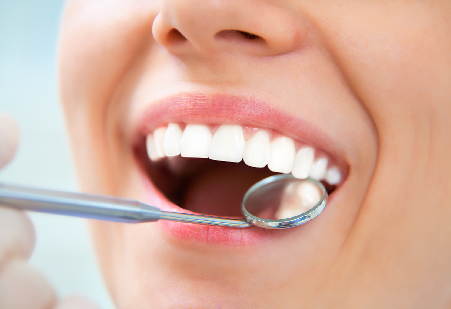 Why Are Dental Check-up and Dental Cleaning So Important for A Healthy Lifestyle?