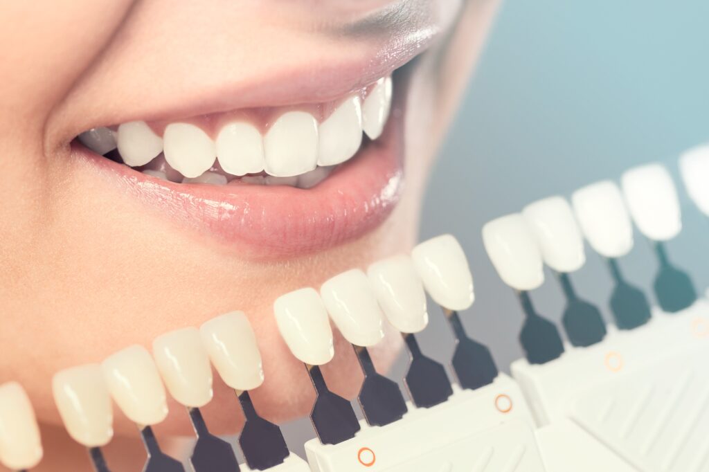 How Do I Know If I Need a Cosmetic Dentist?