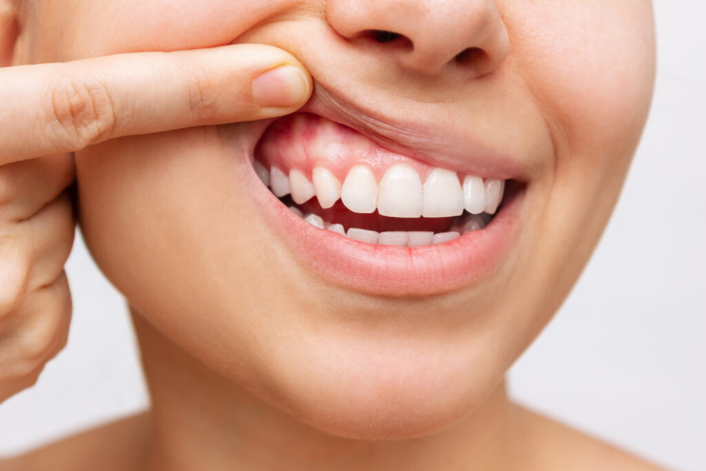 Dental Health Mistakes You Should Avoid For Healthy Teeth And Gums 