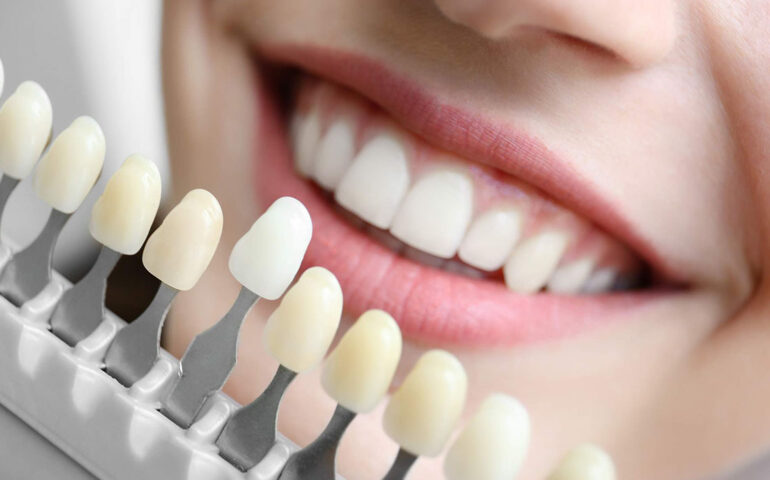 How Does Cosmetic Dentistry Help You Fix Your Smile?