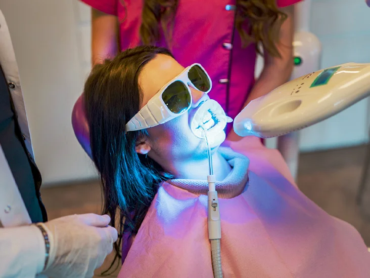 How Does Teeth Whitening Improve Your Life?