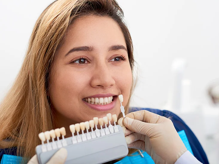 Considering dental veneers in Waikiki? Check the pros and cons