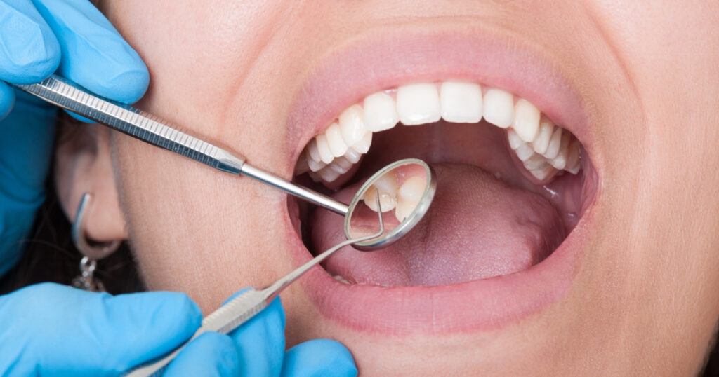 Feel Like Your Tooth Might Be Abscessed?  Ways to Reduce Pain