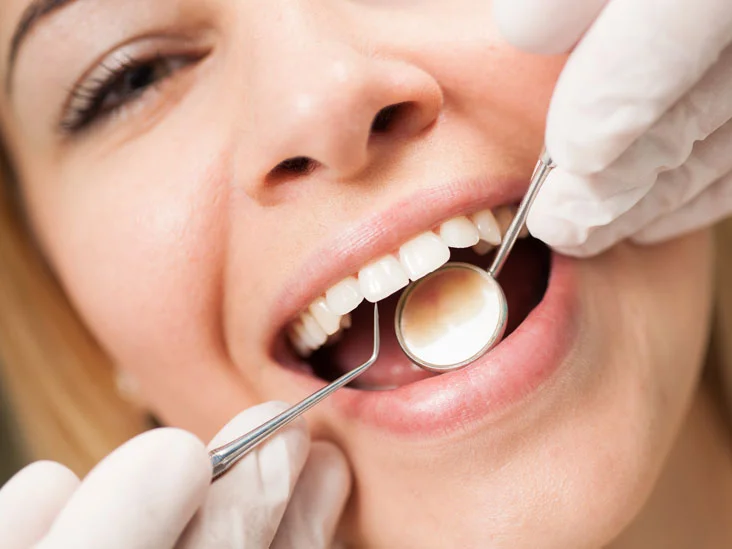 Oral Prophylaxis or Teeth Cleaning: Purpose and Procedure