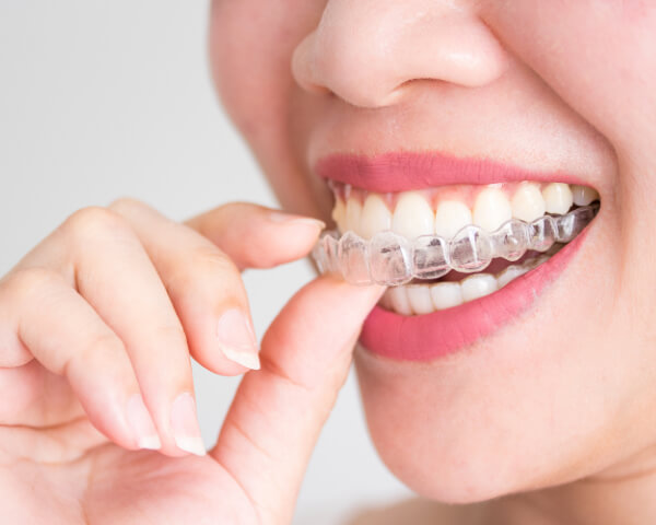 Everything You Need to Know About Orthodontics in Drexel Hill