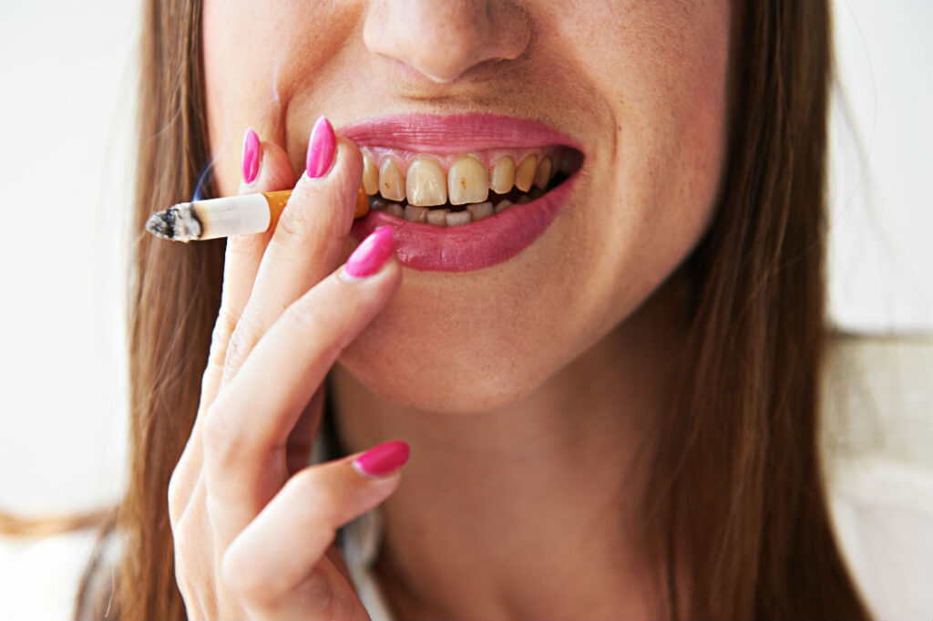 What Are The Effects of Smoking on Teeth?