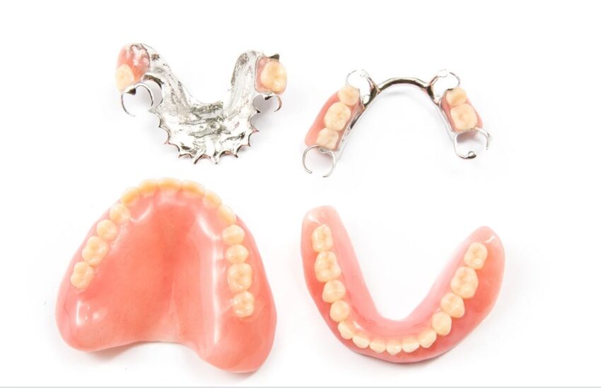 Removable Partial Dentures