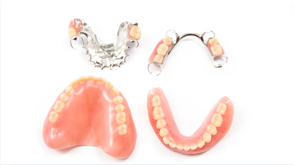 The Impact of Removable Partial Dentures on Life and Dental Habits