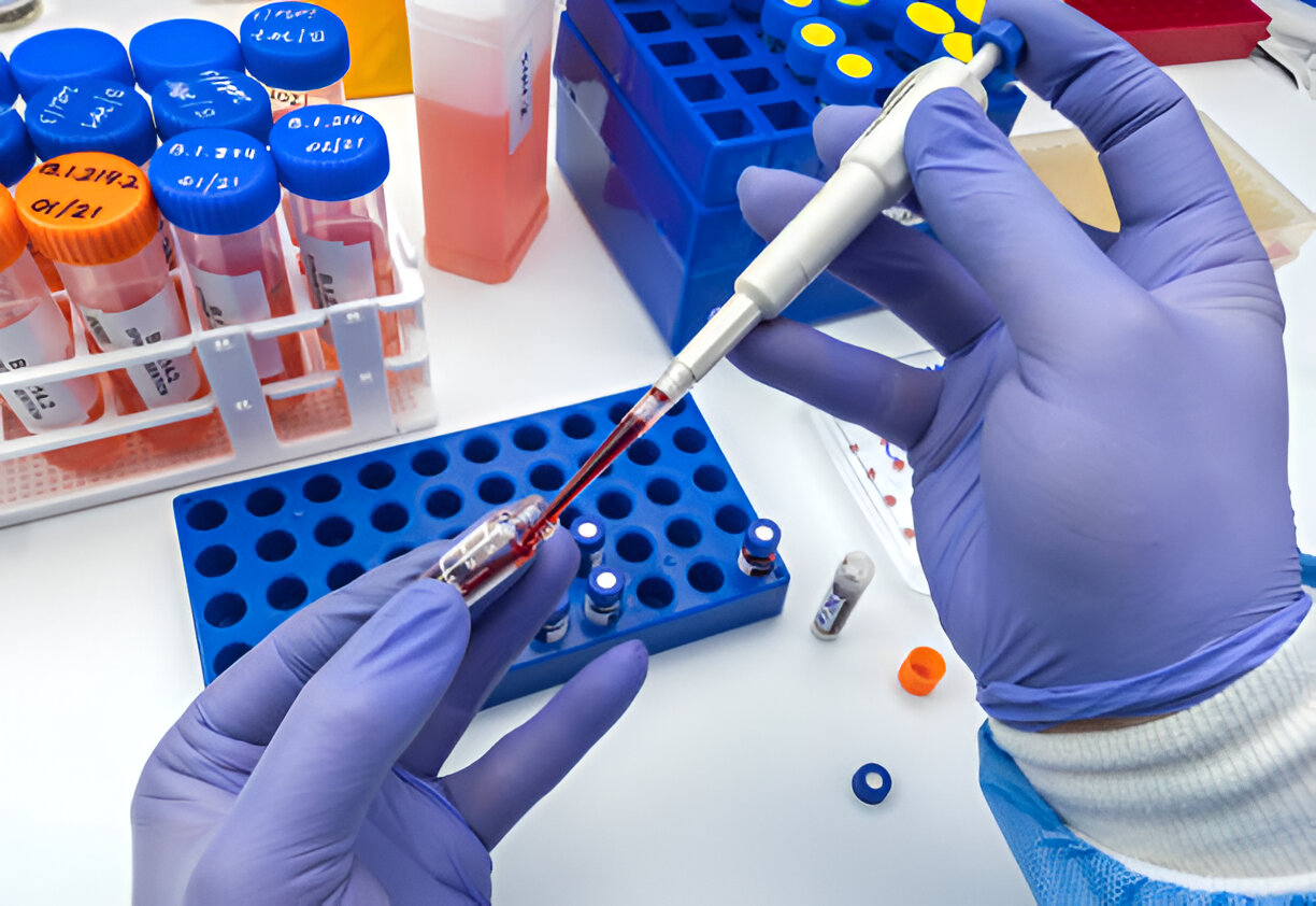 Are Custom-made RT-PCR Test Panels Worthier Than Off-the-Shelf Ones ...