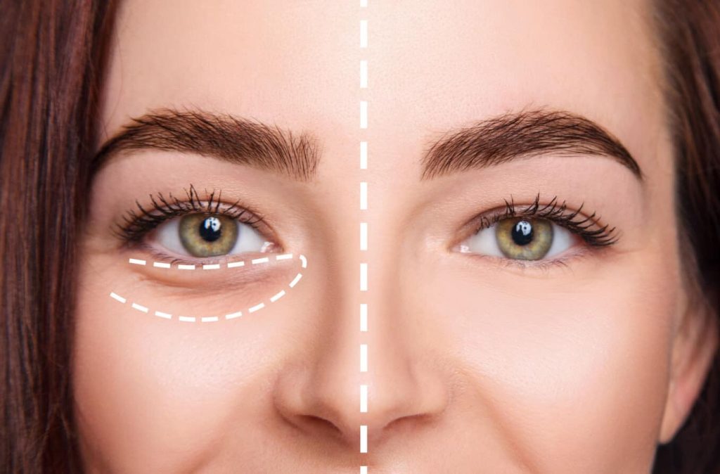 Simple Daily Habits That Help Eliminate Dark Eye Circles