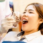 Invisalign Cost Breakdown: A Comprehensive Guide to Your Investment