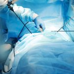 Laser Based Spine Procedures Helping Reduce Recovery Time After Treatment