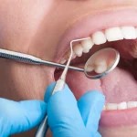 How Cosmetic Dentistry Addresses Stains, Chips, And Gaps