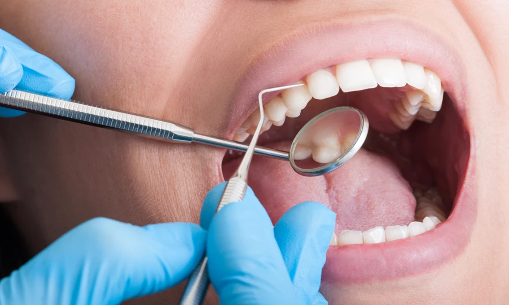 How Cosmetic Dentistry Addresses Stains, Chips, And Gaps